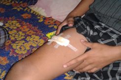Buaya Kembali Serang Warga, Incar Remaja yang Sedang Mandi