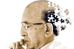Virus Herpes Bisa Menjadi Penyebab Penyakit Alzheimer