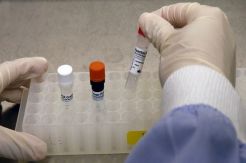 Pria AS Curi dan Bocorkan Status HIV 14.200 Pasien di Singapura
