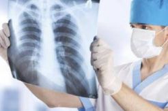 5 Gejala TBC yang Harus Segera Ditangani Dokter
