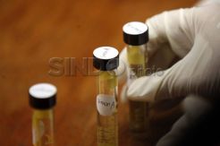 Hasil Tes Urine Artis...
