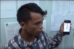 Tim Dokter Rumah Sakit Adam Malik Berhasil Operasi Bayi Kembar Siam Dempet Perut
