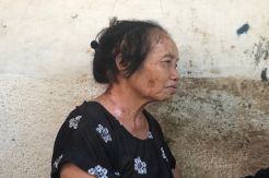 Teror Penyiram Air Kimia Gentayangan di Jakarta Barat