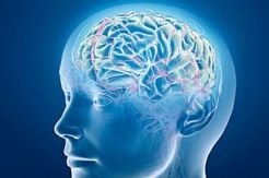 Meluruskan Mitos Seputar Stroke dengan Penanganan Tepat