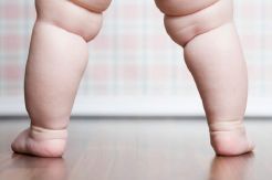 3 Cara Mengurangi Obesitas pada Anak