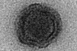 Belum Reda Corona, Kini Muncul Virus Misterius Yara di Brazil