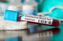 Terus Meluas, Virus Corona Menyebar Hingga ke Sub-Sahara Afrika