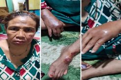 Polisi Buru Pelaku Jembret yang Sebabkan Seorang Ibu Terluka