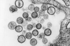 Wabah COVID-19 Belum Reda, Muncul Hantavirus di China