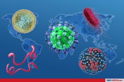Ini 5 Virus Wabah Mematikan di Dunia Satu Dekade Terakhir