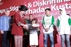 Menkes Peringati Hari Kusta Sedunia