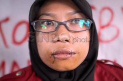 Aksi jahit mulut