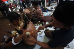 Bekam Tanduk di Pelataran Masjid Cut Meutia