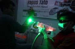 Ratusan Warga Ikuti Program Hapus Tato