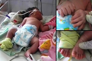 Bayi istimewa lahir...