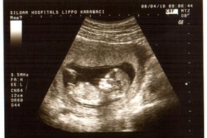 4 hari mayat bayi berada...