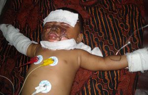 Main lampu teplok, bayi...