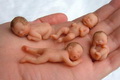 Aborsi, Yeni alami pendarahan...