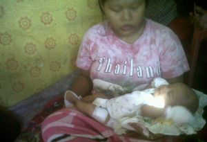 Malapraktik, bayi patah...