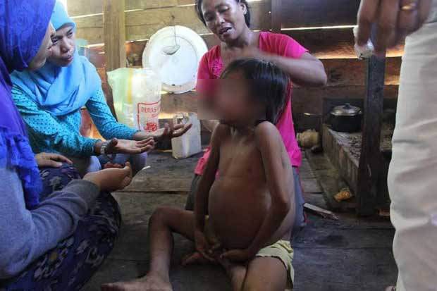 Bocah Tanpa Anus akan...