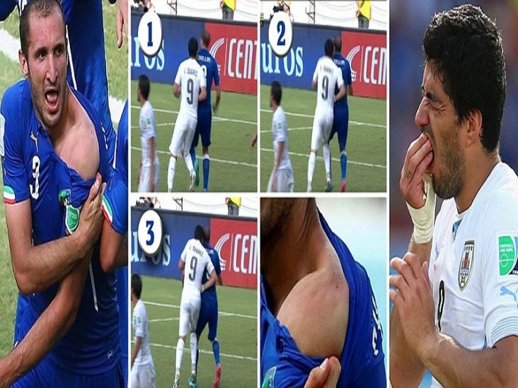 Chiellini Korban Gigitan...