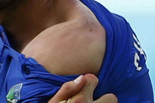 Suarez Butuh Bantuan
