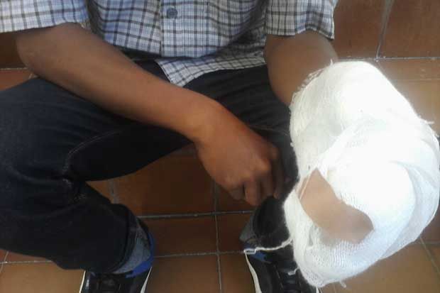 Derita Korban Geng Motor...