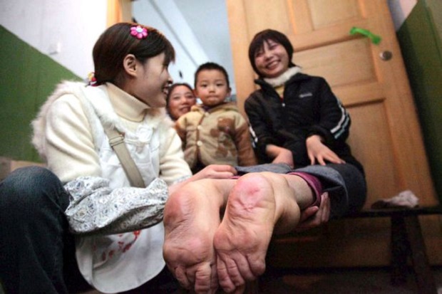 Wanita China Ini Jalani...