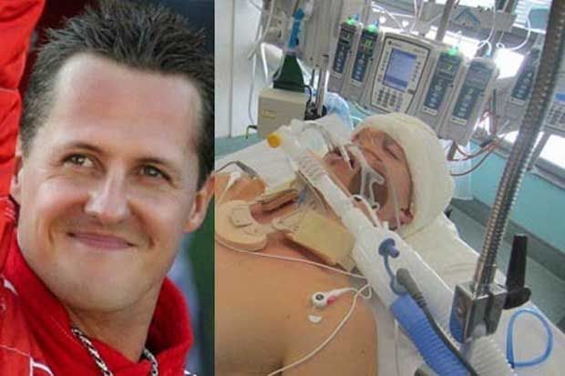 Schumi Sudah Bisa Bangun