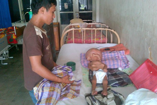Kondisi Anggia Penderita...