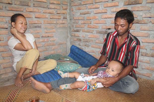 Bimo Bayi Penderita...