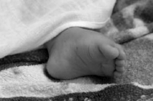 Bayi Kembar Siam Tewas...