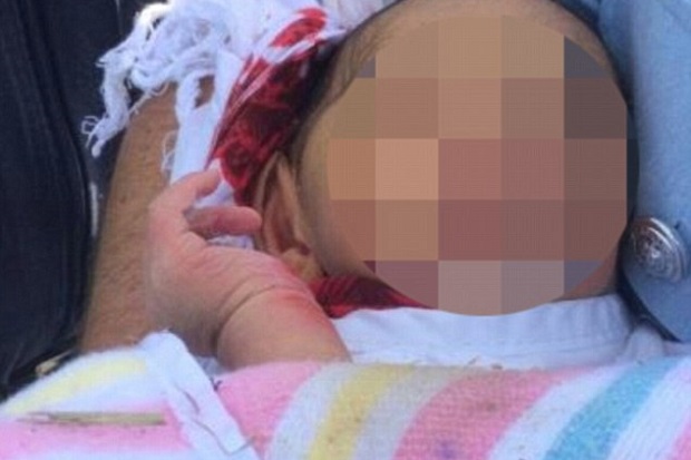 Bayi Ajaib di Australia,...