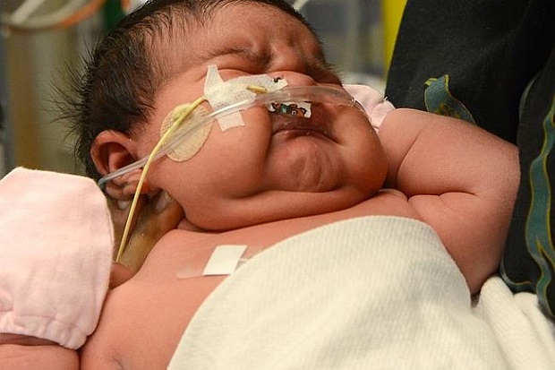 Bayi Raksasa Lahir di...