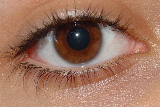 Herpes Zoster Menimbulkan...