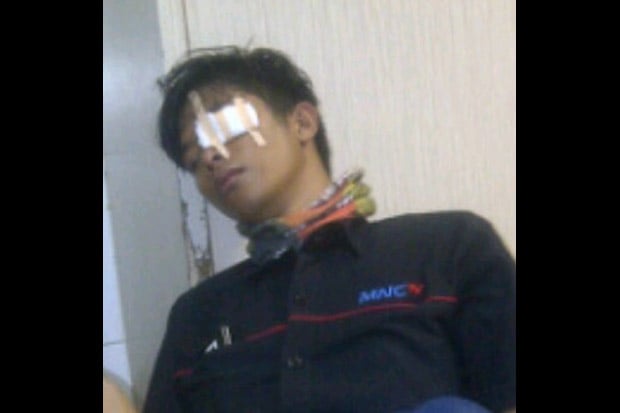 Mata Anjar Nyaris Buta...
