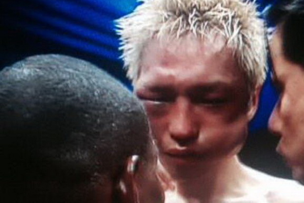 Rigondeaux Hancurkan...