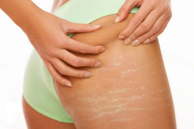 5 Fakta Tentang Stretch...
