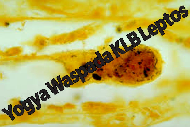 Yogya Waspada KLB Leptos
