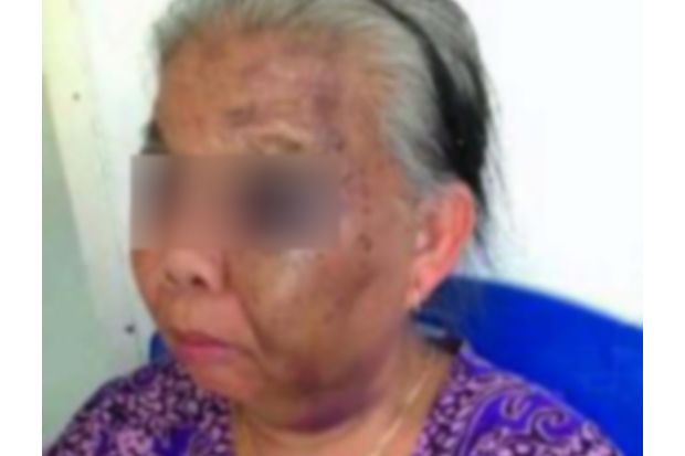 Nenek 60 Tahun Ini Dianiaya...