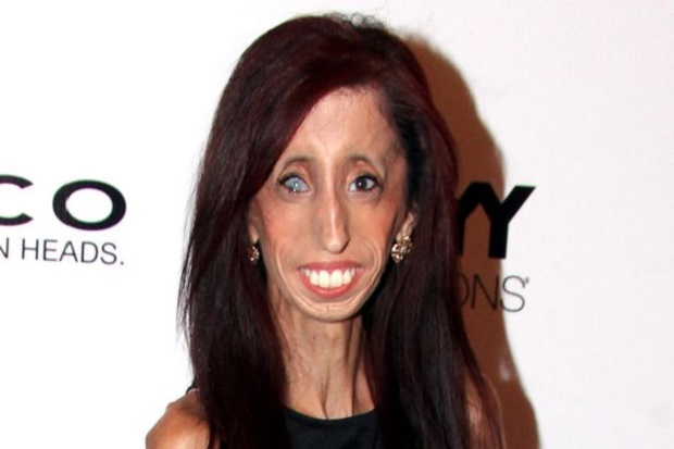 Lizzie Velazques, Wanita...