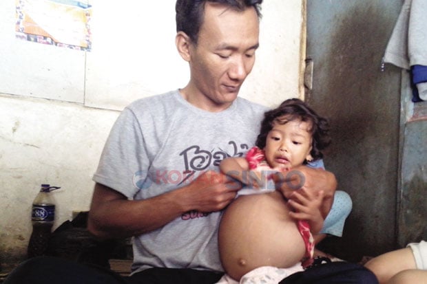 Bocah 1,5 Tahun Menderita...