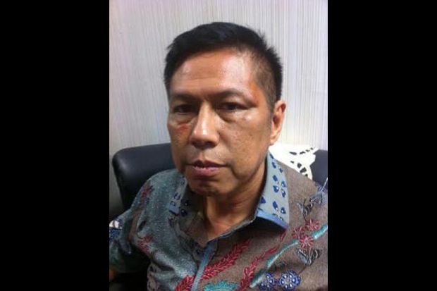 Tiga Kali Dipukul, Beginilah...