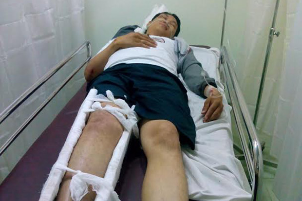 Wartawan Ini Patah Kaki...
