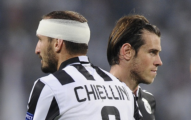Gareth Bale Membantu...