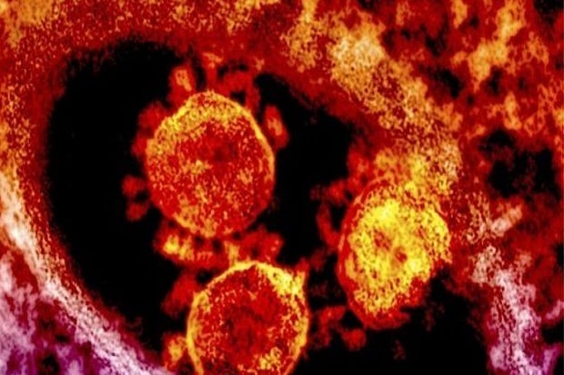 Virus MERS untuk Pertama...