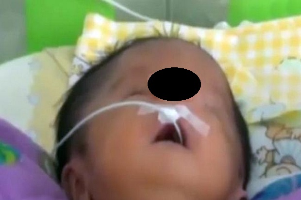 Genetik Langka, Bayi...