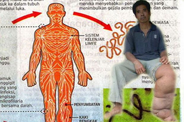 Subang Endemik Penyakit...