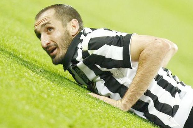 Bek Juventus Ngeri Lihat...