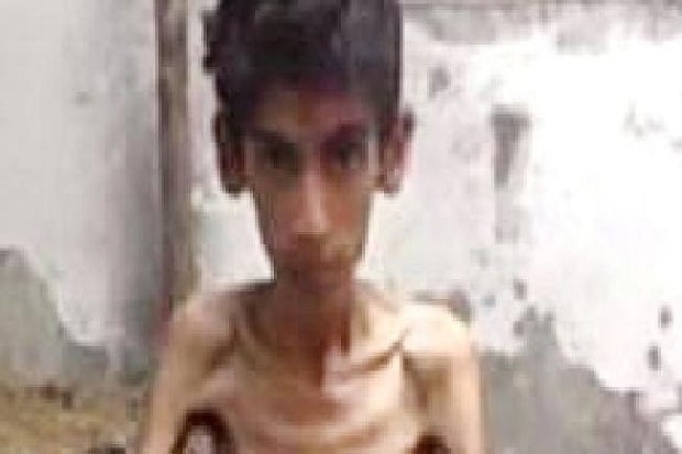 Kelaparan Horor di Madaya,...